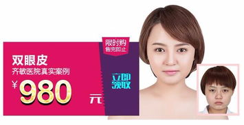 鞍山齊敏 980元雙眼皮手術，開啟美麗雙眸新篇章